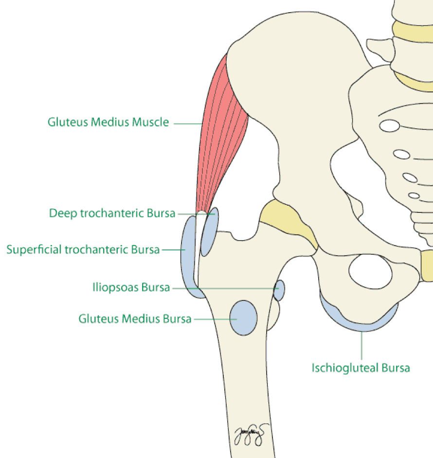 Sit Bone Pain  Ischial Bursitis Treatment in India